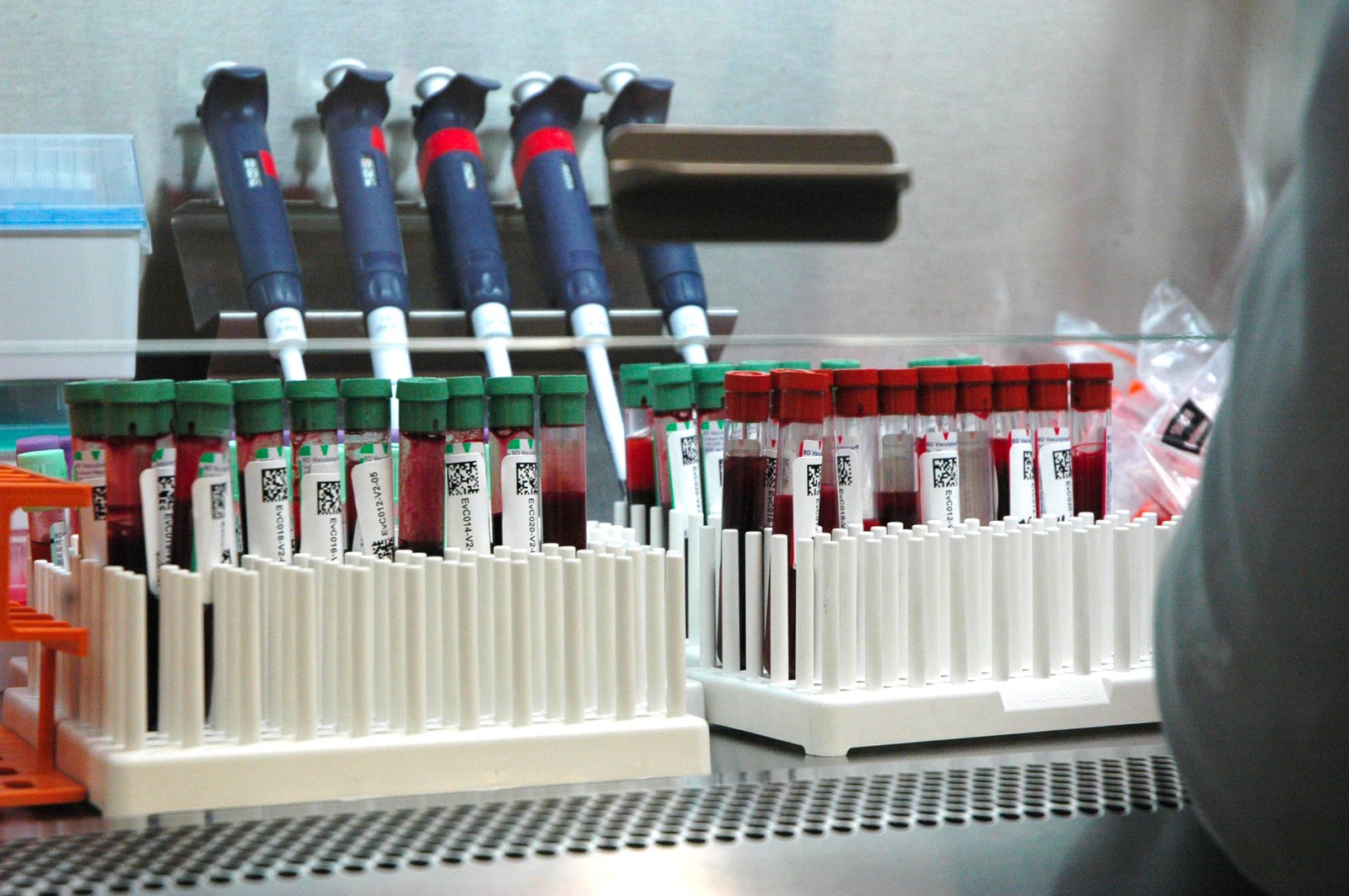 COVID-19 samples awaiting analysis at the PATH laboratory
