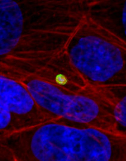 Cryptosporidium